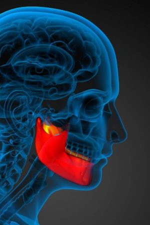 Apnea and Jaw Structure