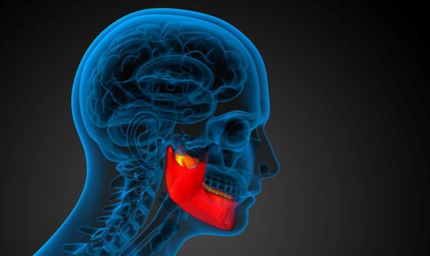 Apnea and Jaw Structure