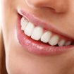 Teeth Whitening