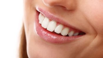 Teeth Whitening