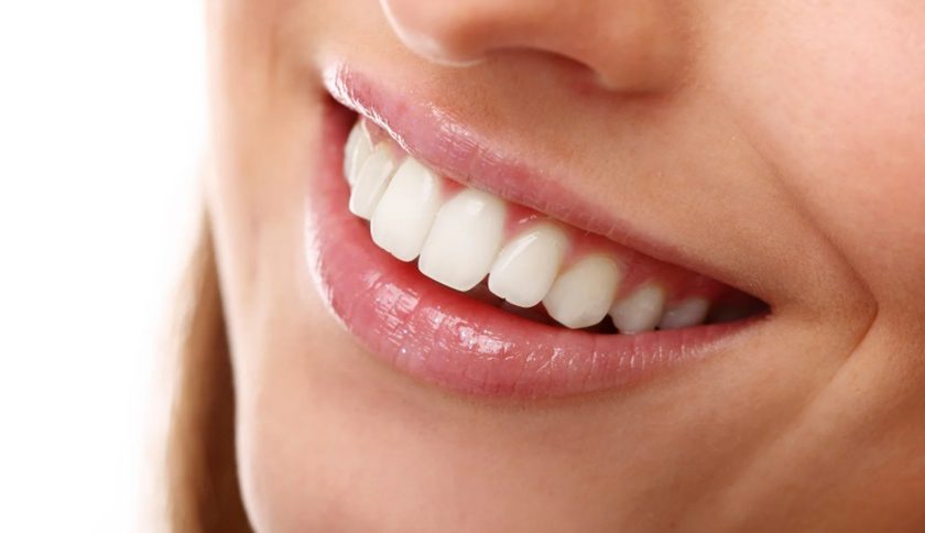 Teeth Whitening