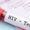 HIV Test in Dubai