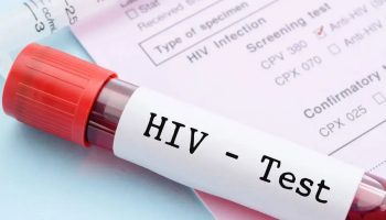 HIV Test in Dubai