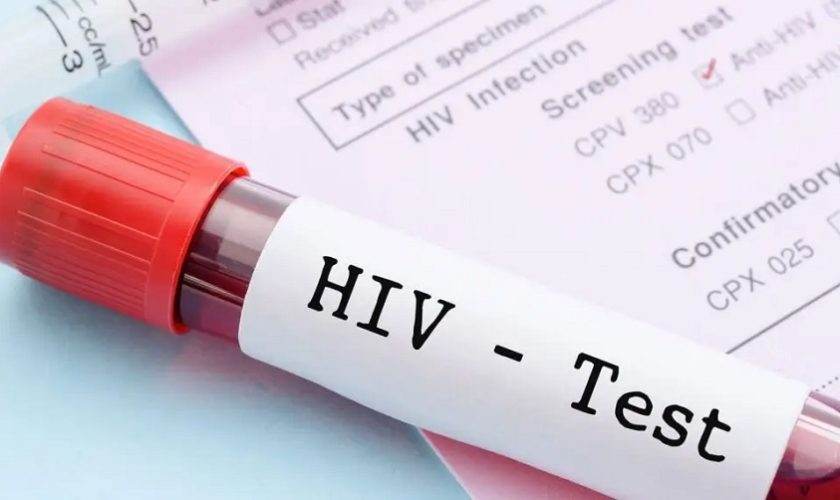 HIV Test in Dubai