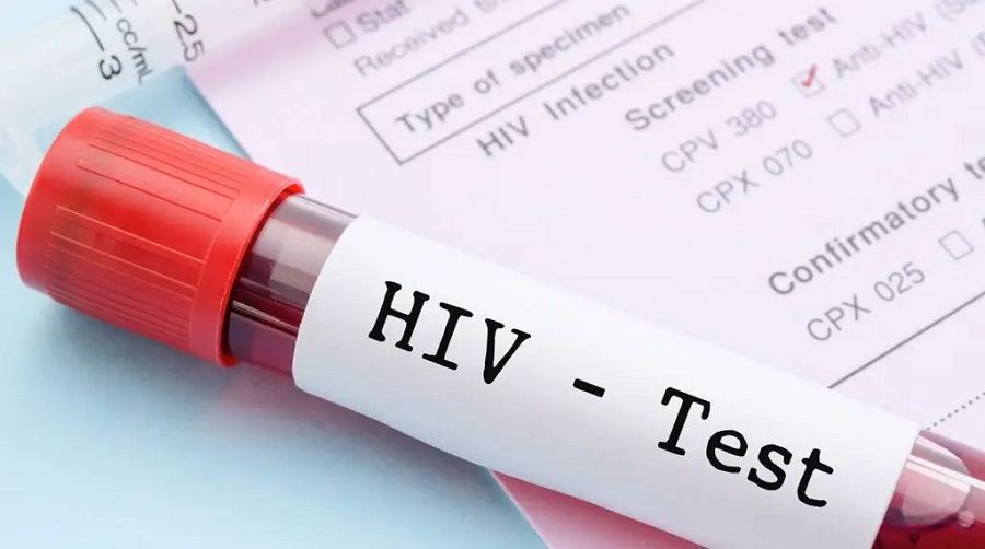 HIV Test in Dubai